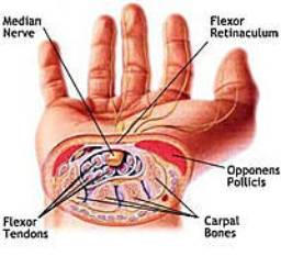 Carpal Tunnel Diagram